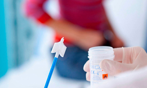 Мазок на ВПЧ: как берут у мужчин и женщин