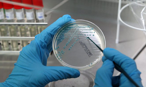 Мазок на гонорею у мужчин и женщин: подготовка и сдача