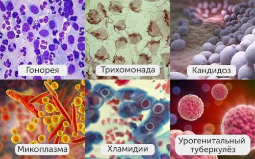 Бактерии венерических заболеваний
