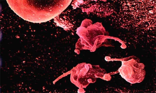 Как вылечить уреаплазму в домашних условиях у женщин и мужчин