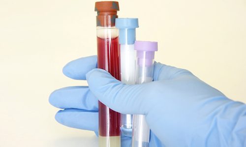 Серологический анализ венозной крови