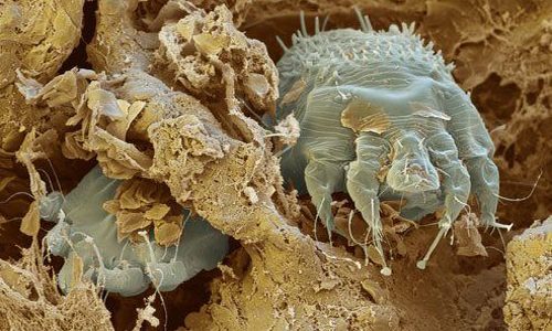 Чесоточный клещ в коже под микроскопом