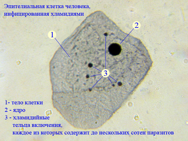 Клетки слизистой полости рта. Клетки буккального эпителия строение. Клетки буккального эпителия под микроскопом. Клетки эпителия ротовой полости. Строение клетки эпителия ротовой полости под микроскопом.