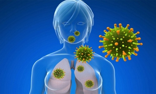 Хламидия и пневмония: симптомы, лечение, причины