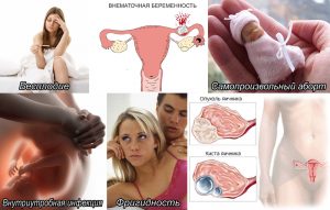 Осложнения хронического вагинита