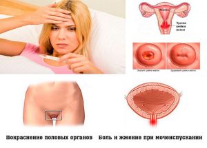 Симптомы у женщин