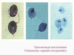 Trichomonas vaginalis