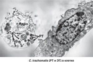 chlamydia trachomatis в клетке