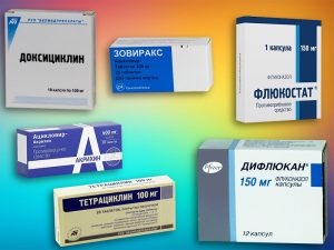 Препараты для лечения эндоцервицита