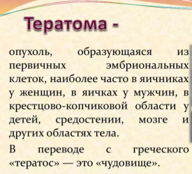 Тератома