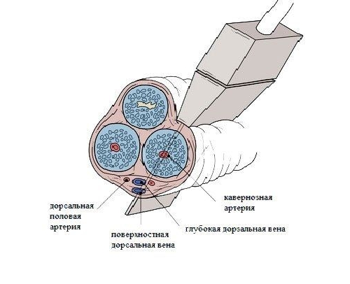 Допплерография артерий полового члена