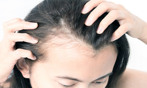 Проблема выпадения волос при сифилисе
