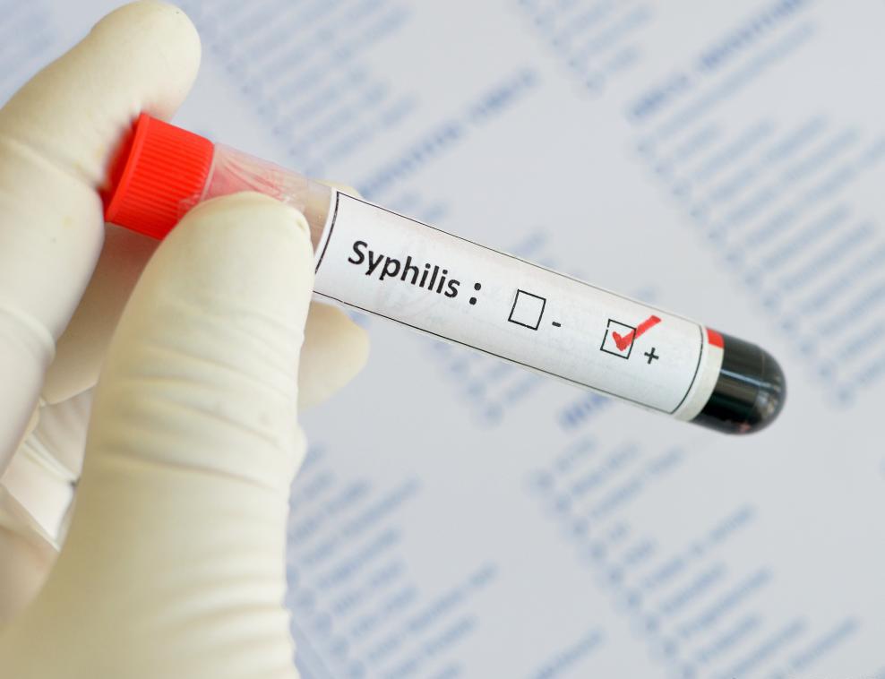 какие анализы у дерматовенеролога делают на сифилис